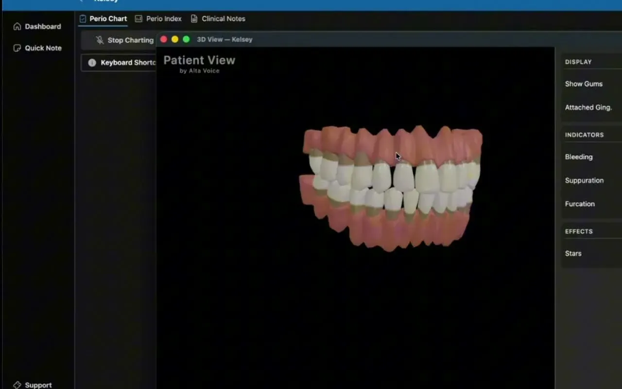 Alta Voice Patient View showing a three-dimensional model of teeth and gums, with controls for displaying bleeding, suppuration, and furcation findings.